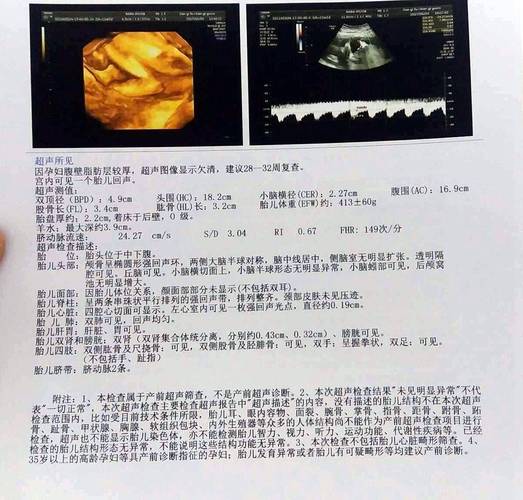 婆请一直问孕妇男女怎么办
