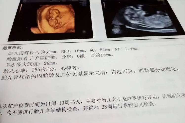 婆请一直问孕妇男女怎么办