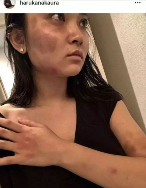 女朋友说自己黑怎么办,如何帮助女朋友自信面对肤色问题