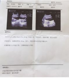 女朋友怀孕一个月不想要怎么办,探讨一个月孕期不想要孩子的应对之道