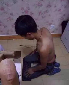 我老婆便秘很严重怎么办,专业建议与实用方法