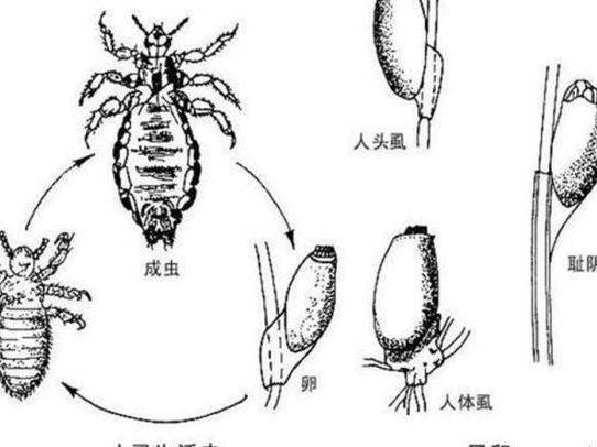 老公有阴虱老婆没有传染是怎么回事,为何老公独中靶心,妻子却幸免于难?