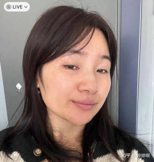 老婆脸上有黑斑怎么办,揭秘老婆美丽肌肤的焕新之道